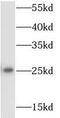 Ribosomal Protein S9 antibody, FNab07486, FineTest, Western Blot image 