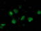 Nicotinamide N-Methyltransferase antibody, LS-B12938, Lifespan Biosciences, Immunofluorescence image 