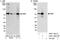 URI1 Prefoldin Like Chaperone antibody, A301-164A, Bethyl Labs, Western Blot image 