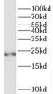 Sm22 antibody, FNab08934, FineTest, Western Blot image 