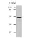 Serpin Family A Member 3 antibody, TA323307, Origene, Western Blot image 