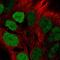 T-cell acute lymphocytic leukemia protein 1 antibody, HPA047866, Atlas Antibodies, Immunofluorescence image 