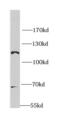 O-Linked N-Acetylglucosamine (GlcNAc) Transferase antibody, FNab05981, FineTest, Western Blot image 