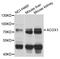 Peroxisomal acyl-coenzyme A oxidase 1 antibody, A03054, Boster Biological Technology, Western Blot image 