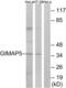 GTPase IMAP family member 5 antibody, LS-C120023, Lifespan Biosciences, Western Blot image 