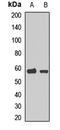 Neuronal acetylcholine receptor subunit alpha-6 antibody, LS-C667932, Lifespan Biosciences, Western Blot image 