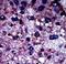 Pfk-m antibody, LS-C101264, Lifespan Biosciences, Immunohistochemistry paraffin image 