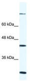 FYVE, RhoGEF and PH domain-containing protein 1 antibody, TA329379, Origene, Western Blot image 