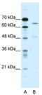 BNC1 antibody, TA338514, Origene, Western Blot image 