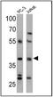 Cannabinoid Receptor 2 antibody, PA1-744, Invitrogen Antibodies, Western Blot image 