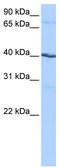 Casein Kinase 1 Gamma 2 antibody, TA340010, Origene, Western Blot image 