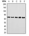 Complement component C8 beta chain antibody, abx225072, Abbexa, Western Blot image 