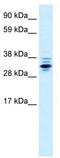 Zinc finger protein 654 antibody, TA331868, Origene, Western Blot image 