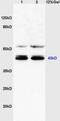 Xyloside Xylosyltransferase 1 antibody, GTX52264, GeneTex, Western Blot image 