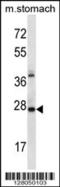 AlkB Homolog 4, Lysine Demethylase antibody, 56-638, ProSci, Western Blot image 