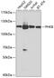 Phosphorylase Kinase Regulatory Subunit Beta antibody, GTX32790, GeneTex, Western Blot image 