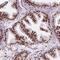 Nuclear Casein Kinase And Cyclin Dependent Kinase Substrate 1 antibody, HPA062351, Atlas Antibodies, Immunohistochemistry paraffin image 