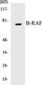 B-Raf Proto-Oncogene, Serine/Threonine Kinase antibody, EKC1065, Boster Biological Technology, Western Blot image 