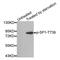Sp1 Transcription Factor antibody, MBS128365, MyBioSource, Western Blot image 