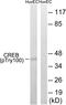 Macrophage-CSF Receptor antibody, PA5-40171, Invitrogen Antibodies, Western Blot image 