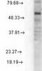 Gamma-Aminobutyric Acid Type A Receptor Delta Subunit antibody, TA326532, Origene, Western Blot image 
