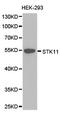 Serine/Threonine Kinase 11 antibody, LS-C192909, Lifespan Biosciences, Western Blot image 