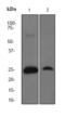 Superoxide Dismutase 2 antibody, TA301157, Origene, Western Blot image 