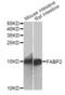 Fatty Acid Binding Protein 2 antibody, orb48372, Biorbyt, Western Blot image 