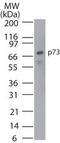 Tumor Protein P73 antibody, TA336444, Origene, Western Blot image 