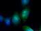 Mediator of RNA polymerase II transcription subunit 12 antibody, 20028-1-AP, Proteintech Group, Immunofluorescence image 