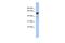 Sphingolipid Transporter 2 antibody, A10754, Boster Biological Technology, Western Blot image 