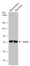 Heat Shock Protein Family A (Hsp70) Member 9 antibody, GTX133283, GeneTex, Western Blot image 