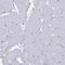 Calmodulin Like 5 antibody, HPA040725, Atlas Antibodies, Immunohistochemistry frozen image 