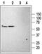 Potassium channel subfamily K member 3 antibody, PA5-77589, Invitrogen Antibodies, Western Blot image 