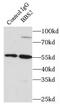 Bardet-Biedl syndrome 2 protein antibody, FNab00815, FineTest, Immunoprecipitation image 