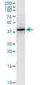 Pentraxin-related protein PTX3 antibody, H00005806-M01, Novus Biologicals, Western Blot image 