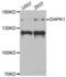 Death Associated Protein Kinase 1 antibody, abx004391, Abbexa, Western Blot image 