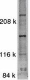 Mitogen-Activated Protein Kinase Kinase Kinase 5 antibody, GTX31637, GeneTex, Western Blot image 