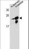 RAB25, Member RAS Oncogene Family antibody, LS-C162373, Lifespan Biosciences, Western Blot image 