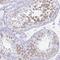 Deleted in azoospermia-like antibody, NBP1-85307, Novus Biologicals, Immunohistochemistry paraffin image 