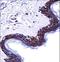 Desmoglein 1 antibody, LS-C167542, Lifespan Biosciences, Immunohistochemistry paraffin image 
