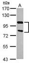 Zinc Finger CCCH-Type Containing, Antiviral 1 antibody, NBP2-20940, Novus Biologicals, Western Blot image 