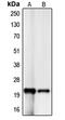 p21 antibody, LS-C351989, Lifespan Biosciences, Western Blot image 