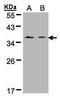 FRP antibody, GTX102371, GeneTex, Western Blot image 