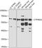 Cholesterol 24-hydroxylase antibody, GTX65985, GeneTex, Western Blot image 
