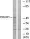 Corticotropin Releasing Hormone Receptor 1 antibody, TA313693, Origene, Western Blot image 