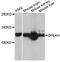 5-Oxoprolinase, ATP-Hydrolysing antibody, A12032, ABclonal Technology, Western Blot image 