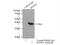 Retinol Dehydrogenase 10 antibody, 14644-1-AP, Proteintech Group, Immunoprecipitation image 