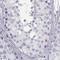 Cone-Rod Homeobox antibody, NBP1-88060, Novus Biologicals, Immunohistochemistry paraffin image 