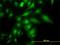 Trafficking Protein Particle Complex 4 antibody, H00051399-M01, Novus Biologicals, Immunocytochemistry image 